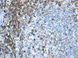 Immunohistochemistry (Formalin/PFA-fixed paraffin-embedded sections) - Anti-CD6/T12 antibody [EPR4056] (AB109218)