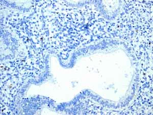 Immunohistochemistry (Formalin/PFA-fixed paraffin-embedded sections) - Anti-CD6/T12 antibody [EPR4056] (AB109218)