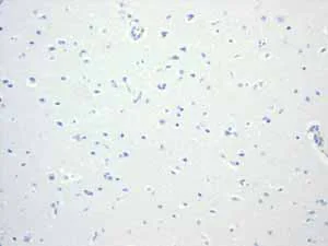 Immunohistochemistry (Formalin/PFA-fixed paraffin-embedded sections) - Anti-CD6/T12 antibody [EPR4056] (AB109218)