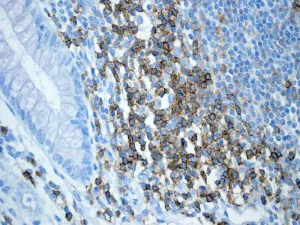 Immunohistochemistry (Formalin/PFA-fixed paraffin-embedded sections) - Anti-CD6/T12 antibody [EPR4056] (AB109218)