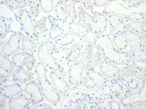 Immunohistochemistry (Formalin/PFA-fixed paraffin-embedded sections) - Anti-CD6/T12 antibody [EPR4056] (AB109218)