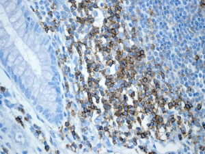 Immunohistochemistry (Formalin/PFA-fixed paraffin-embedded sections) - Anti-CD6/T12 antibody [EPR4056] - BSA and Azide free (AB247796)
