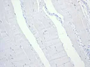 Immunohistochemistry (Formalin/PFA-fixed paraffin-embedded sections) - Anti-CD6/T12 antibody [EPR4057] (AB109217)