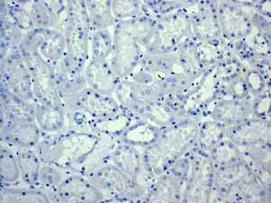 Immunohistochemistry (Formalin/PFA-fixed paraffin-embedded sections) - Anti-CD6/T12 antibody [EPR4057] (AB109217)