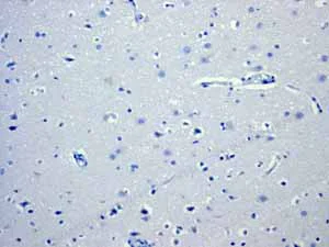 Immunohistochemistry (Formalin/PFA-fixed paraffin-embedded sections) - Anti-CD6/T12 antibody [EPR4057] (AB109217)