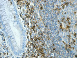 Immunohistochemistry (Formalin/PFA-fixed paraffin-embedded sections) - Anti-CD6/T12 antibody [EPR4057] (AB109217)