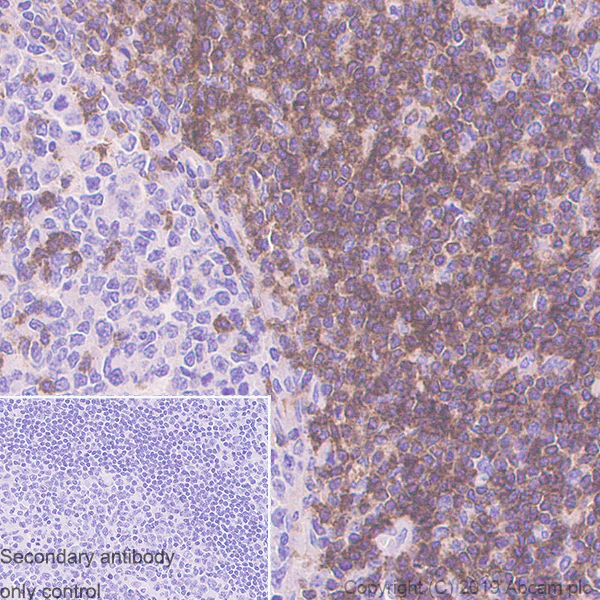 Immunohistochemistry (Formalin/PFA-fixed paraffin-embedded sections) - Anti-CD6/T12 antibody [EPR4057] (AB109217)