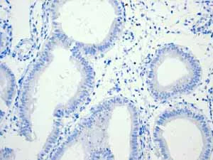 Immunohistochemistry (Formalin/PFA-fixed paraffin-embedded sections) - Anti-CD6/T12 antibody [EPR4057] (AB109217)