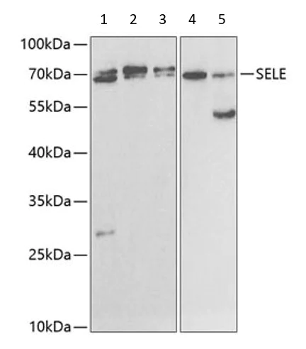 Anti-CD62E antibody (ab185698) | Abcam
