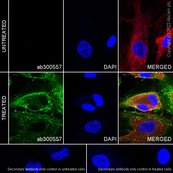 Immunocytochemistry/ Immunofluorescence - Anti-CD62E antibody [EPR25616-62] - BSA and Azide free (AB300558)
