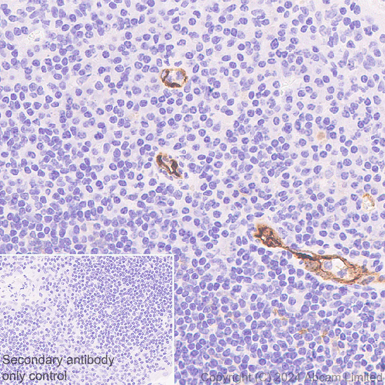 Immunohistochemistry (Formalin/PFA-fixed paraffin-embedded sections) - Anti-CD62E antibody [EPR28605-81] (AB319105)