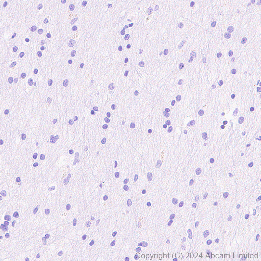 Immunohistochemistry (Formalin/PFA-fixed paraffin-embedded sections) - Anti-CD62E antibody [EPR28605-81] (AB319105)