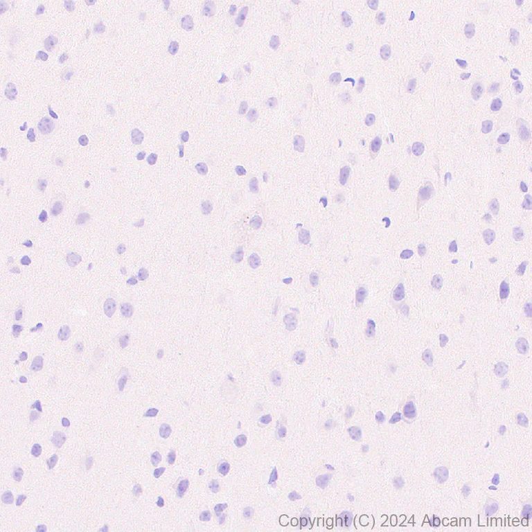 Immunohistochemistry (Formalin/PFA-fixed paraffin-embedded sections) - Anti-CD62E antibody [EPR28605-81] (AB319105)