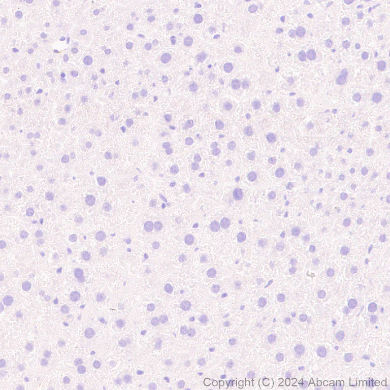 Immunohistochemistry (Formalin/PFA-fixed paraffin-embedded sections) - Anti-CD62E antibody [EPR28605-81] (AB319105)