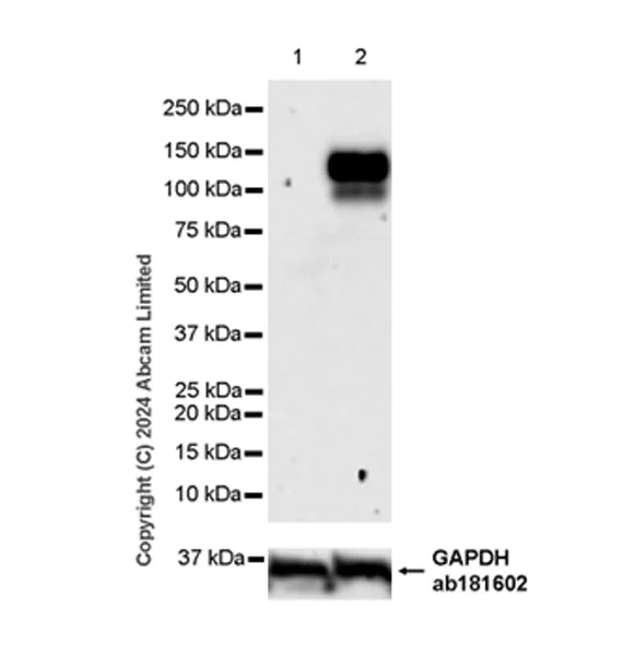 Western blot - Anti-CD62E antibody [EPR28605-81] (AB319105)