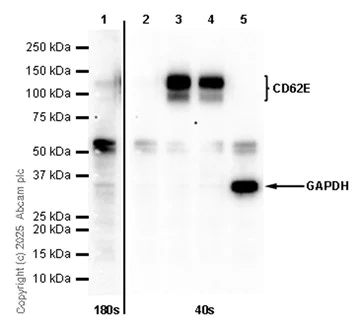 Western blot - Anti-CD62E antibody [EPR28605-81] (AB319105)