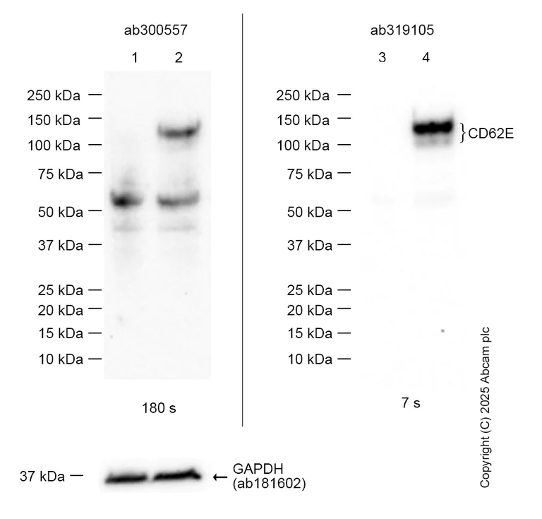 Western blot - Anti-CD62E antibody [EPR28605-81] (AB319105)