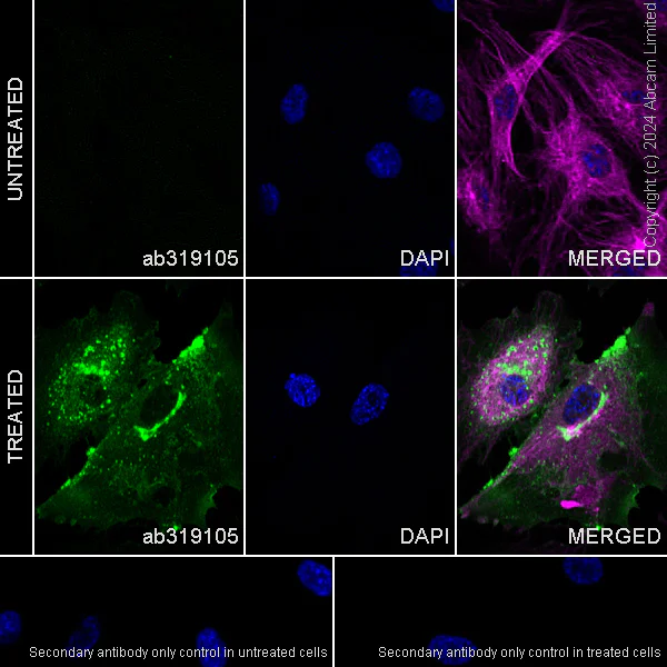 Immunocytochemistry/ Immunofluorescence - Anti-CD62E antibody [EPR28605-81] - BSA and Azide free (AB319106)