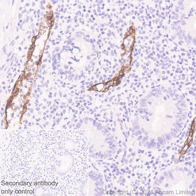 Immunohistochemistry (Formalin/PFA-fixed paraffin-embedded sections) - Anti-CD62E antibody [EPR28605-81] - BSA and Azide free (AB319106)