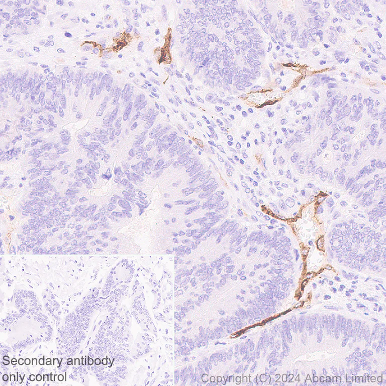 Immunohistochemistry (Formalin/PFA-fixed paraffin-embedded sections) - Anti-CD62E antibody [EPR28605-81] - BSA and Azide free (AB319106)