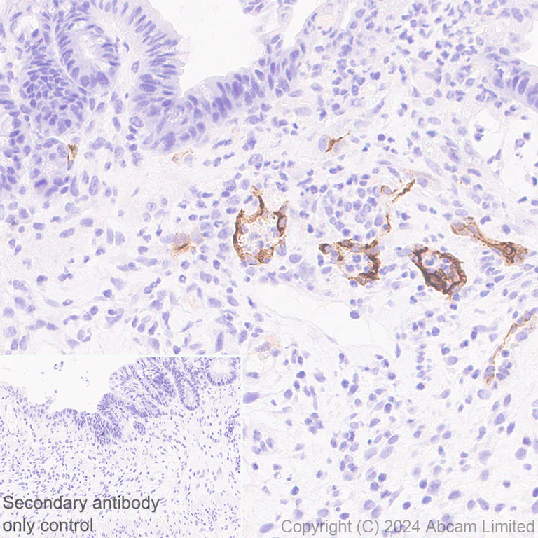 Immunohistochemistry (Formalin/PFA-fixed paraffin-embedded sections) - Anti-CD62E antibody [EPR28605-81] - BSA and Azide free (AB319106)