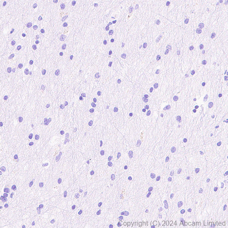 Immunohistochemistry (Formalin/PFA-fixed paraffin-embedded sections) - Anti-CD62E antibody [EPR28605-81] - BSA and Azide free (AB319106)
