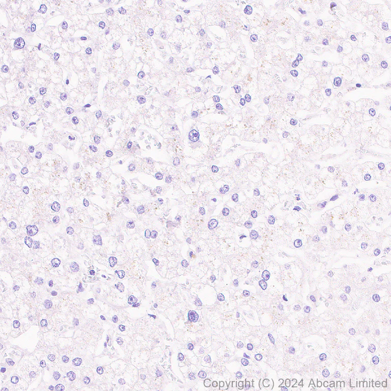 Immunohistochemistry (Formalin/PFA-fixed paraffin-embedded sections) - Anti-CD62E antibody [EPR28605-81] - BSA and Azide free (AB319106)