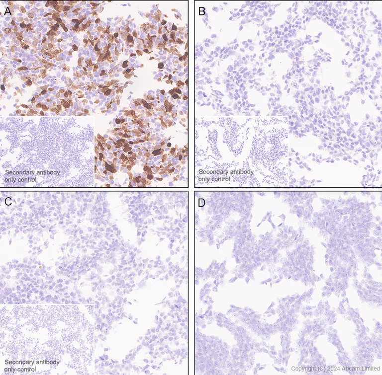 Immunohistochemistry (Formalin/PFA-fixed paraffin-embedded sections) - Anti-CD62E antibody [EPR28605-81] - BSA and Azide free (AB319106)