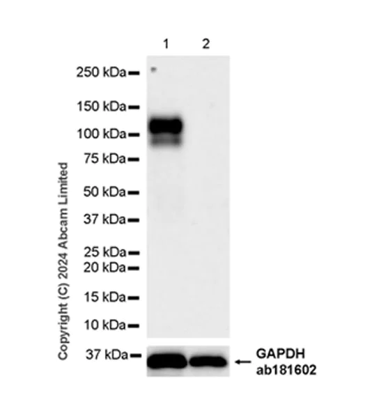 Western blot - Anti-CD62E antibody [EPR28605-81] - BSA and Azide free (AB319106)