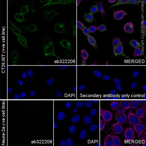 Immunocytochemistry/ Immunofluorescence - Anti-CD62E antibody [RM2070] (AB322206)