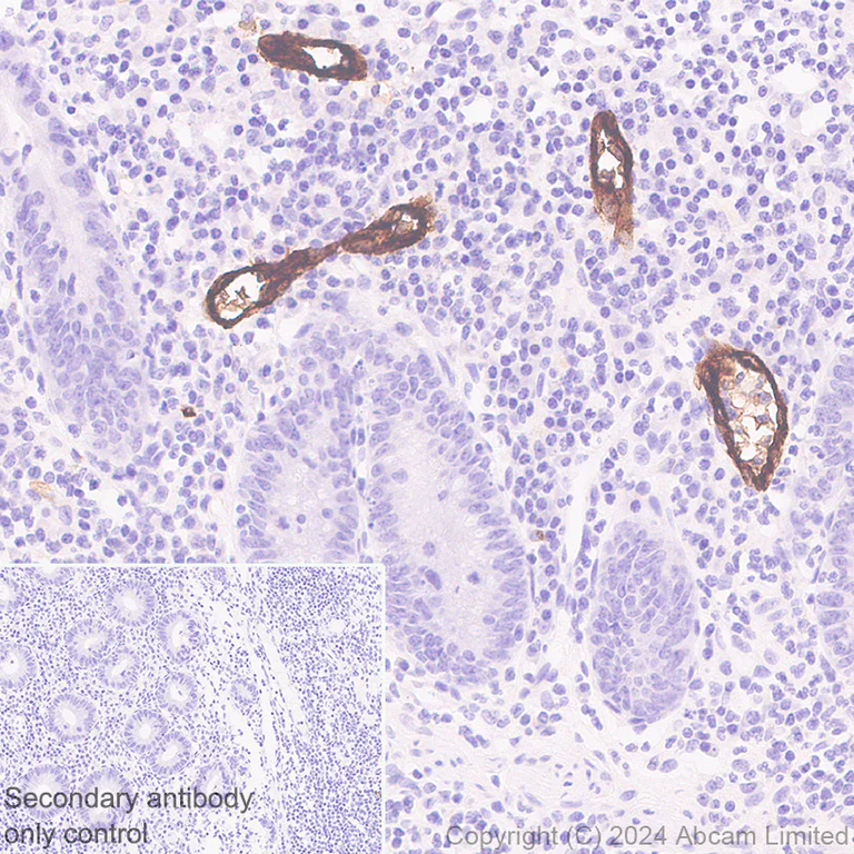 Immunohistochemistry (Formalin/PFA-fixed paraffin-embedded sections) - Anti-CD62E antibody [RM2070] (AB322206)