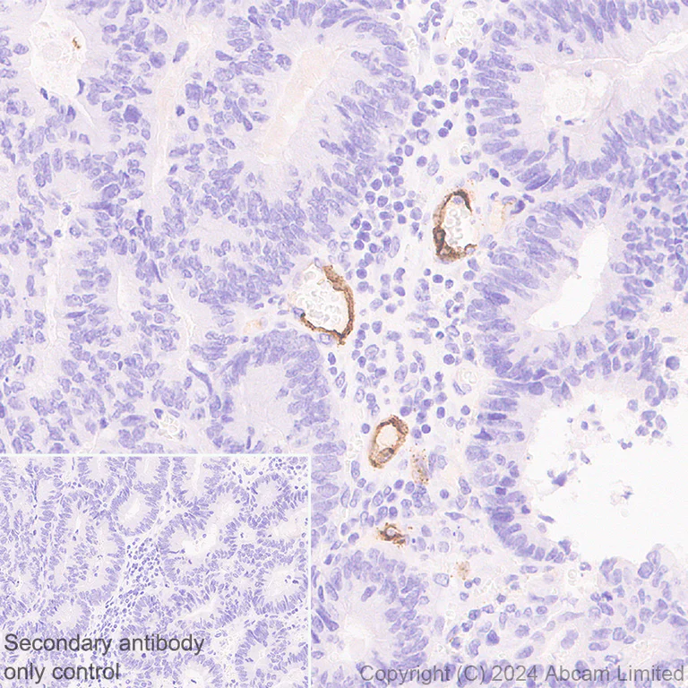 Immunohistochemistry (Formalin/PFA-fixed paraffin-embedded sections) - Anti-CD62E antibody [RM2070] (AB322206)