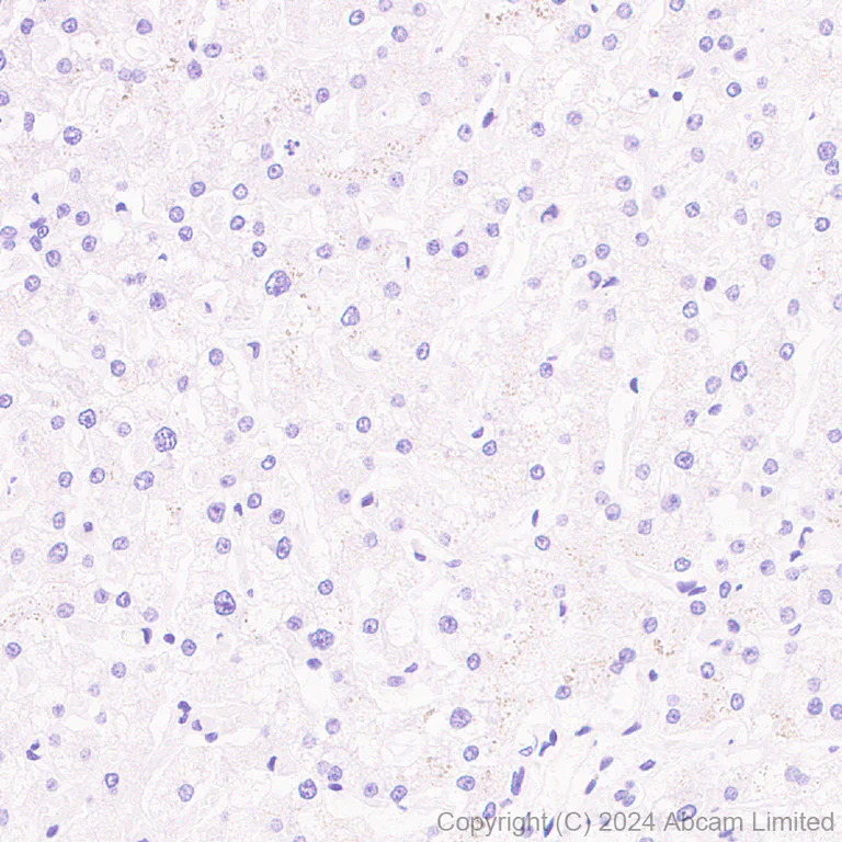 Immunohistochemistry (Formalin/PFA-fixed paraffin-embedded sections) - Anti-CD62E antibody [RM2070] (AB322206)