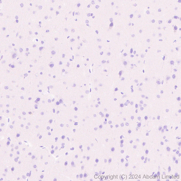 Immunohistochemistry (Formalin/PFA-fixed paraffin-embedded sections) - Anti-CD62E antibody [RM2070] (AB322206)