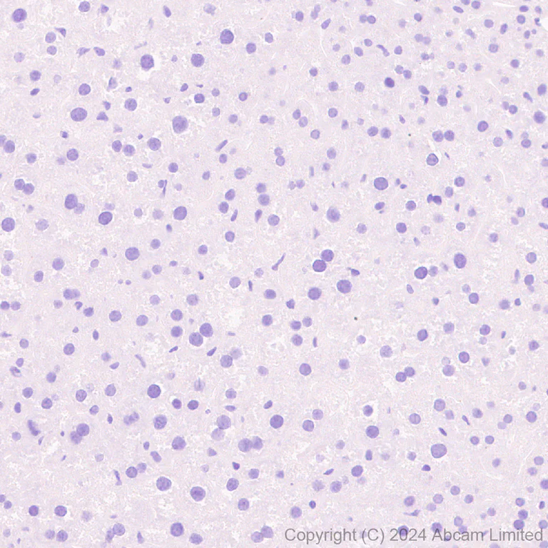 Immunohistochemistry (Formalin/PFA-fixed paraffin-embedded sections) - Anti-CD62E antibody [RM2070] (AB322206)