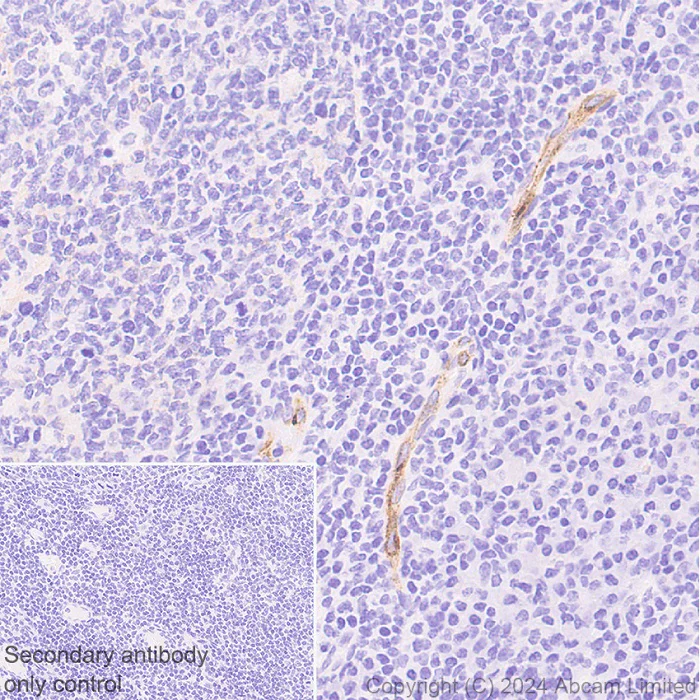 Immunohistochemistry (Formalin/PFA-fixed paraffin-embedded sections) - Anti-CD62E antibody [RM2070] (AB322206)