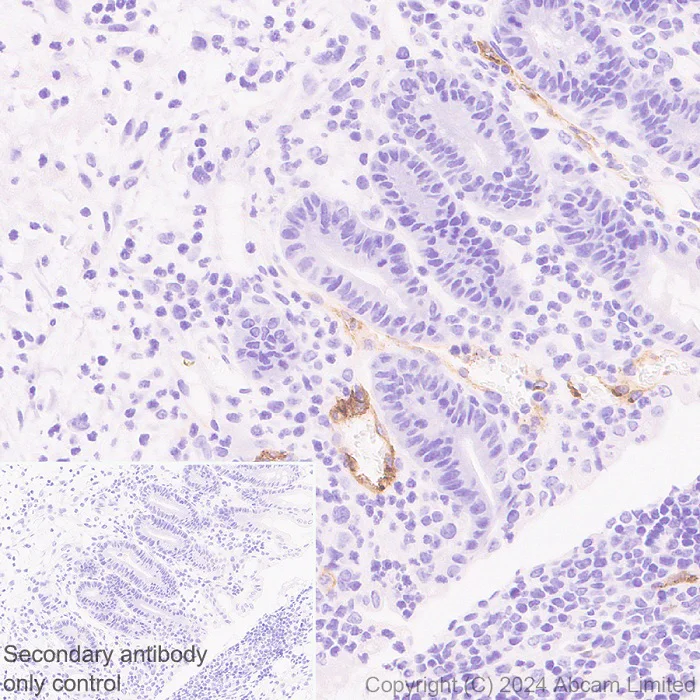 Immunohistochemistry (Formalin/PFA-fixed paraffin-embedded sections) - Anti-CD62E antibody [RM2070] (AB322206)