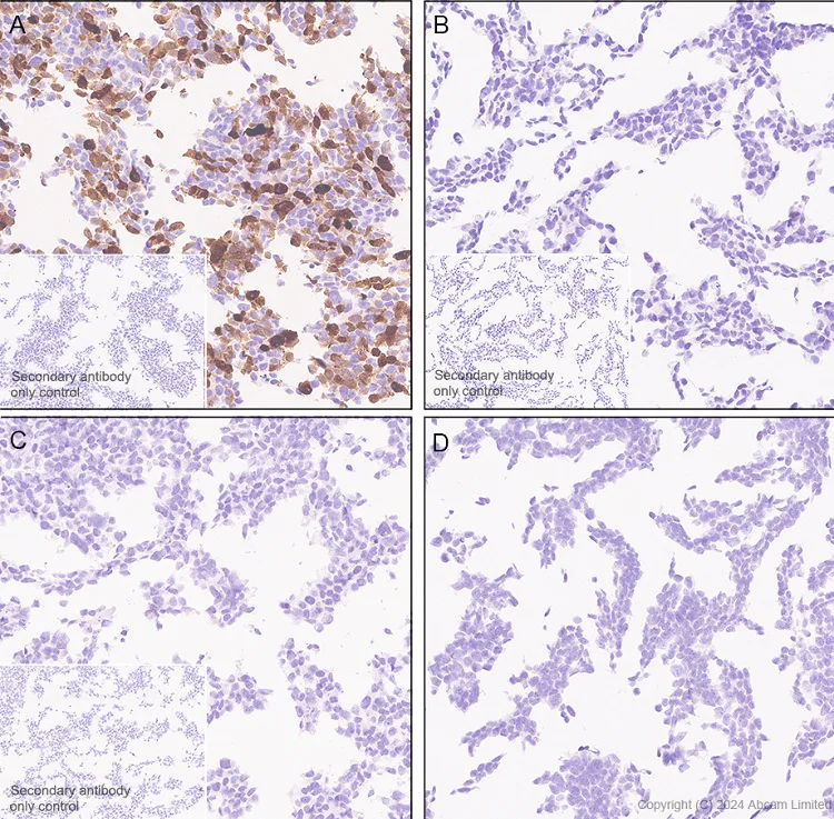 Immunohistochemistry (Formalin/PFA-fixed paraffin-embedded sections) - Anti-CD62E antibody [RM2070] (AB322206)