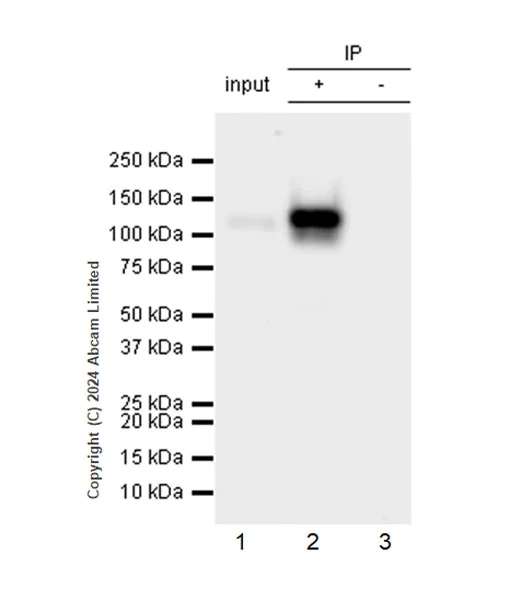 Immunoprecipitation - Anti-CD62E antibody [RM2070] (AB322206)