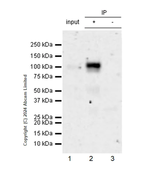 Immunoprecipitation - Anti-CD62E antibody [RM2070] (AB322206)
