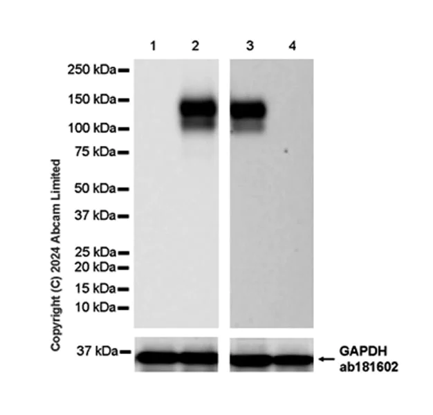 Western blot - Anti-CD62E antibody [RM2070] (AB322206)