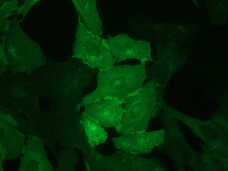 Immunocytochemistry/ Immunofluorescence - Anti-CD62E antibody [UZ6] (AB2497)