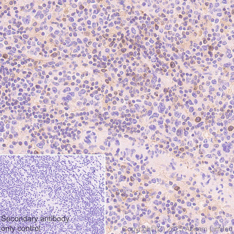 Immunohistochemistry (Formalin/PFA-fixed paraffin-embedded sections) - Anti-CD62L antibody [EPR30513-525] (AB324590)