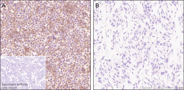 Immunohistochemistry (Formalin/PFA-fixed paraffin-embedded sections) - Anti-CD62L antibody [EPR30513-525] (AB324590)