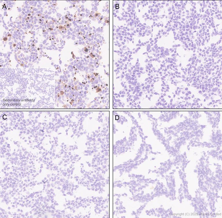 Immunohistochemistry (Formalin/PFA-fixed paraffin-embedded sections) - Anti-CD62L antibody [EPR30513-525] (AB324590)