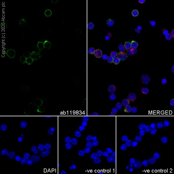 Anti-CD62L antibody [MEL-14] (ab119834) | Abcam