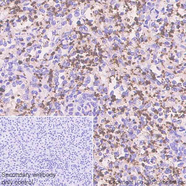 Immunohistochemistry (Formalin/PFA-fixed paraffin-embedded sections) - Anti-CD62P antibody [EPR22850-190] (AB255822), expandable thumbnail