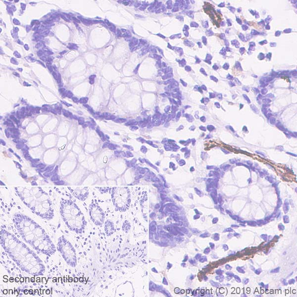 Immunohistochemistry (Formalin/PFA-fixed paraffin-embedded sections) - Anti-CD62P antibody [EPR22850-190] (AB255822), expandable thumbnail