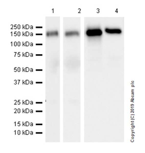 Western blot - Anti-CD62P antibody [EPR22850-190] (AB255822), expandable thumbnail