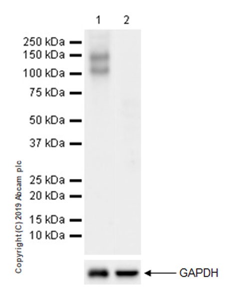 Western blot - Anti-CD62P antibody [EPR22850-190] (AB255822), expandable thumbnail